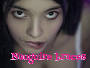 Nauguire_braces